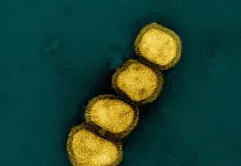 Alerta: Nova Onda de Gripe H1N1 Avança – O Que Você Precisa Saber para se Proteger