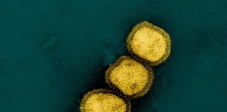 Alerta: Nova Onda de Gripe H1N1 Avança – O Que Você Precisa Saber para se Proteger